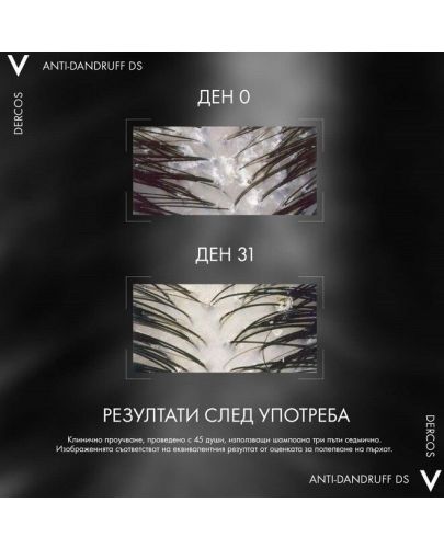 Vichy Dercos Комплект - Шампоан против пърхот за суха коса Anti-dandruff DS + Пълнител, 200 + 500 ml - 5